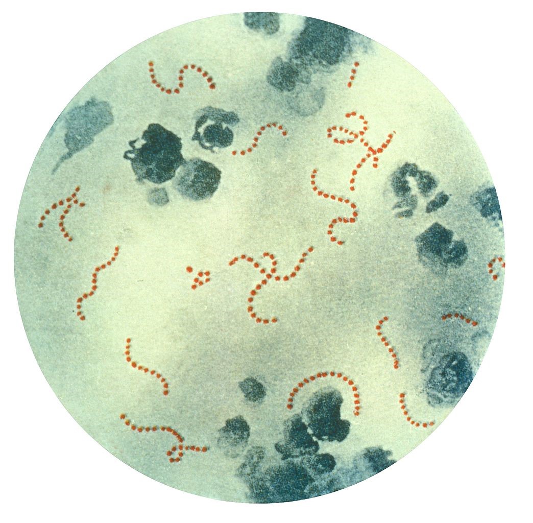 Group A Streptococcus disease in Hong Kong children: an overview